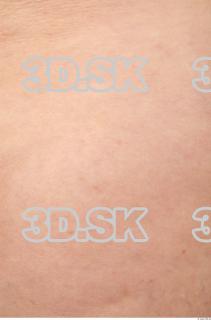 Skin texture of Ada 0002